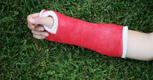 Can You Play Soccer with a Broken Wrist? Guidelines for Soccer Referees & Players